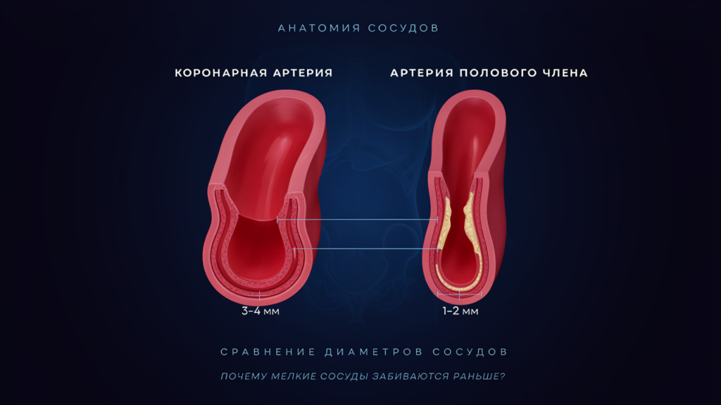 Эректильная дисфункция